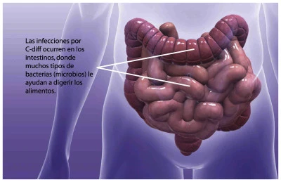 Prevención y tratamiento de infecciones en el tracto gastrointestinal