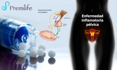 Beneficios de la terapia hormonal en la enfermedad inflamatoria pélvica