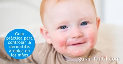 Prevenir y tratar afecciones de piel en bebés y niños